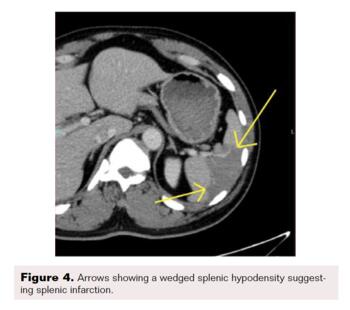 Farquharson Figure 4