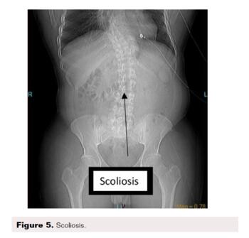Farquharson Figure 5