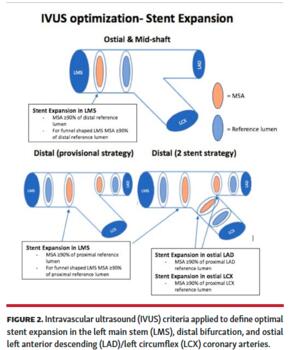 Intravascular ultrasound (IVUS) criteria applied to define optimal stent expansion in the left main stem