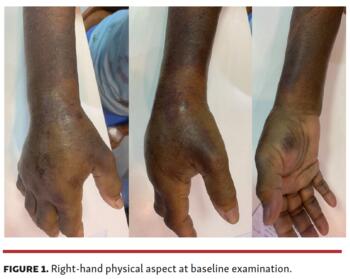 Right-hand physical aspect at baseline examination.