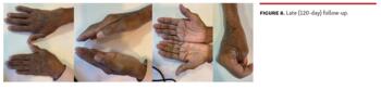 Figure 8. Late (120-day) follow-up.
