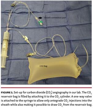 Singh Renal Artery Figure 1