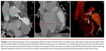 Computed tomography coronary angiography. 