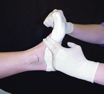 Sanjay Sharma, MS, DPM, FDFM shares that in India, the custom orthosis market is in its nascent stages. Moreover, he notes that most of the population in his country favors sandals and flip-flops over a shoe, and walks barefooted indoors. Photo courtesy of Doug Richie, Jr. DPM