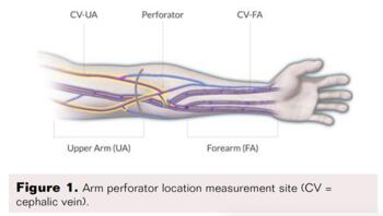 Pneumatic_compression_device_Figure 1