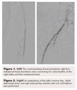 Figure 1 and Figure 2