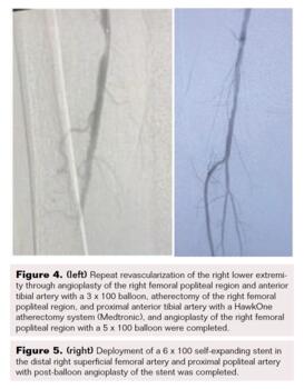 Figure 4 and Figure 5