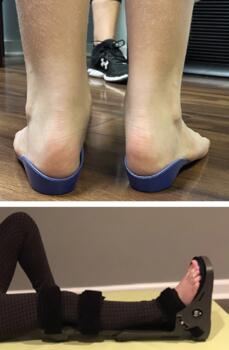 According to the authors, tailoring your approach and treatment for each patient and thoroughly explaining the “why” can lead to success.