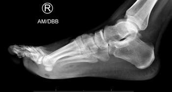 Here one can see a radiographic view of the case in question.