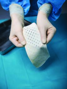 Kerecis Omega3 SurgiBind™