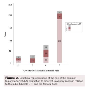 Figure 3. CFA bifurcation