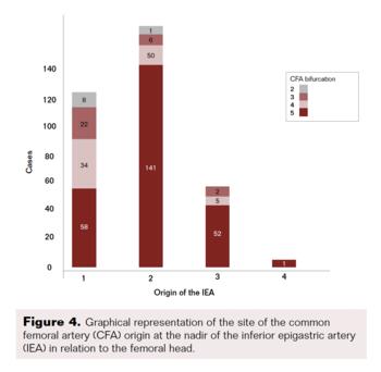 Figure 4. Origin of IEA
