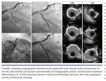 Baseline angiography
