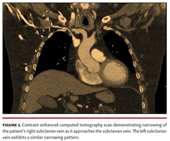 Contrast-enhanced computed tomography scan.