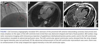 Coronary angiography