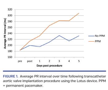 Average PR interval over time following transcatheter aortic valve implantation procedure using the Lotus device. PPM = permanent pacemaker.