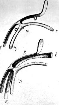 Figure 1: Leroy’s intubation aid (Image: Wood Library Museum of Anesthesiology)