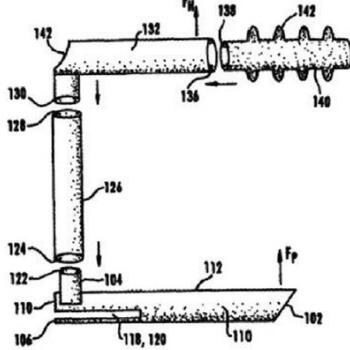 Figure 2: Babington’s glottiscope