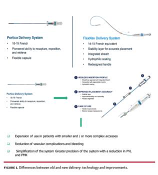Differences between old and new delivery: technology and improvements.
