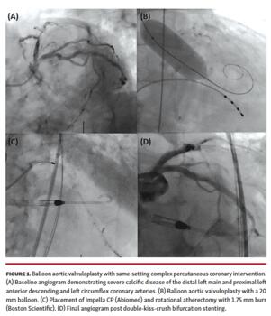 Balloon aortic valvuloplasty with same-setting complex percutaneous coronary intervention.