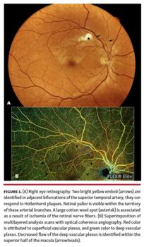 Right eye retinography.