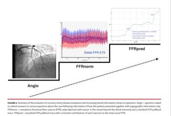 Summary of the evolution of coronary artery disease evaluation and increasing tiered information shown to operators.