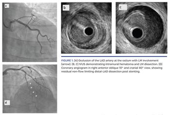 Occlusion of the LAD artery at the ostium with LM involvement