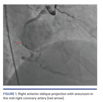 "FIGURE 1. Right anterior oblique projection the mid right coronary artery (red arrow)."