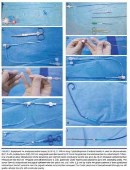 Equipment for endomyocardial biopsy