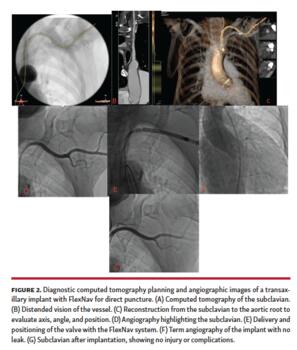 Diagnostic computed tomography