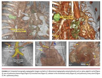 Computed tomography angiographic images