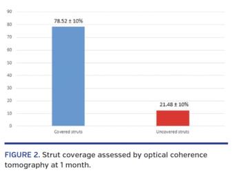 Strut coverage assessed by optical coherence tomography at 1 month.