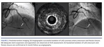 Postintervention imaging