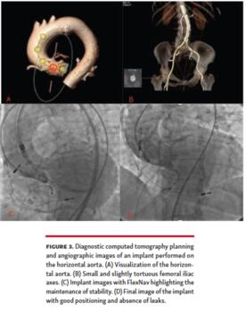 Diagnostic computed tomography