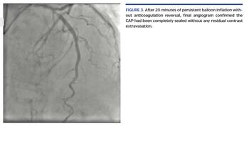 After 20 minutes of persistent balloon inflation without anticoagulation reversal, final angiogram confirmed the CAP had been completely sealed without any residual contrast extravasation.