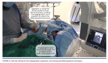 Cath lab setting for the angiographic, guidewire, and ultrasound (AGU) guidance technique.