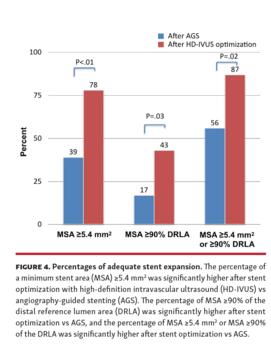 Percentages of adequate stent expansion.