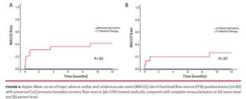 Kaplan-Meier curves of major adverse cardiac and cerebrovascular event