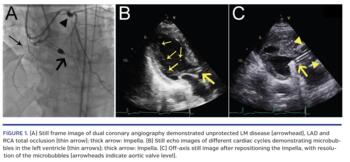 Impella-Induced Left Ventricular Microbubbles