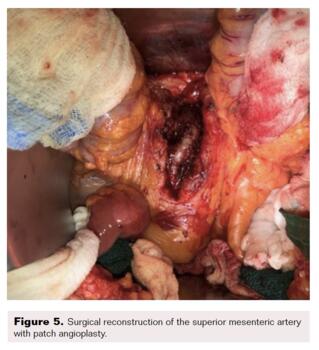 Surgical reconstruction. 
