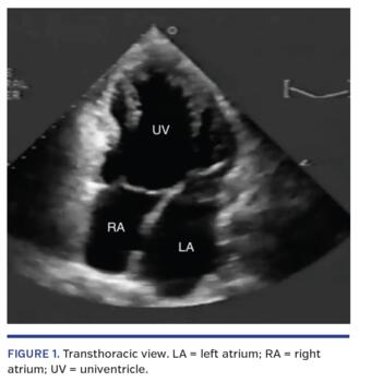 Transthoracic view
