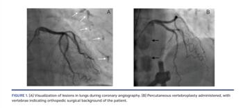 Visualization of lesions in lungs
