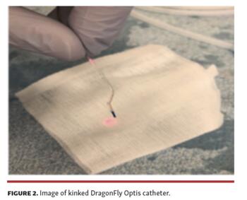 Image of kinked DragonFly Optis catheter.