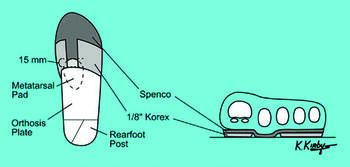 Figure courtesy of Kevin Kirby, DPM
