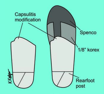 Figure courtesy of Kevin Kirby, DPM